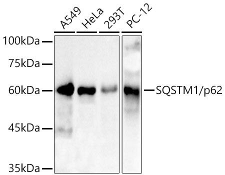 SQSTM1/p62 Rabbit Polyclonal Antibody