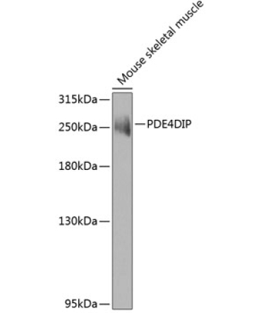PDE4DIP Rabbit Polyclonal Antibody