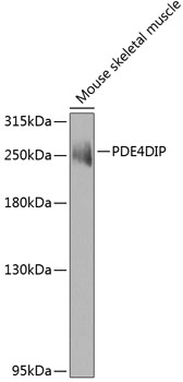 PDE4DIP Rabbit Polyclonal Antibody
