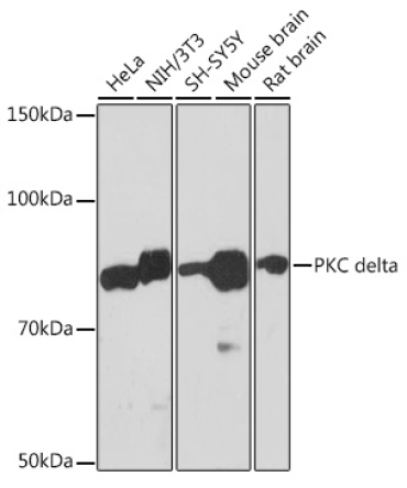 PKC delta Rabbit Monoclonal Antibody
