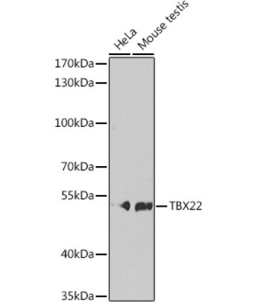 TBX22 Rabbit Polyclonal Antibody