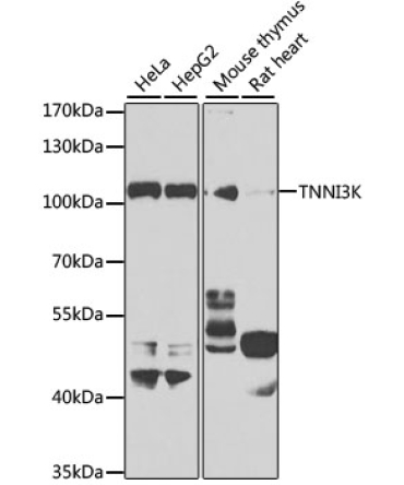 TNNI3K Rabbit Polyclonal Antibody