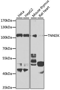 TNNI3K Rabbit Polyclonal Antibody
