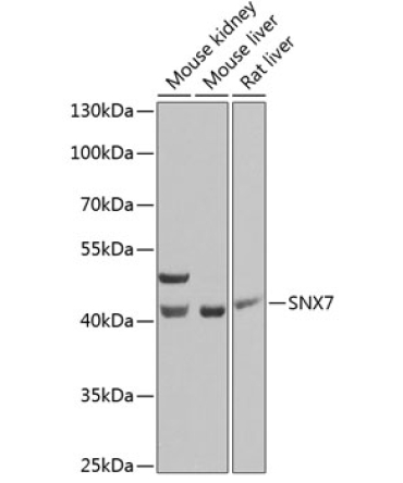 SNX7 Rabbit Polyclonal Antibody