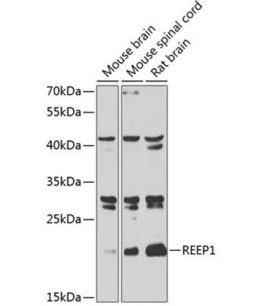 REEP1 Rabbit Polyclonal Antibody