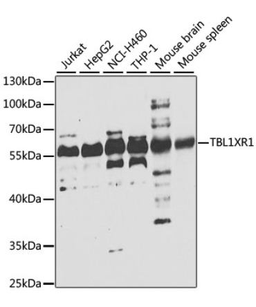 TBL1XR1 Rabbit Polyclonal Antibody