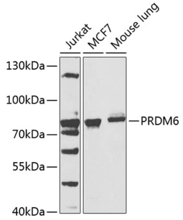 PRDM6 Rabbit Polyclonal Antibody