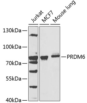 PRDM6 Rabbit Polyclonal Antibody