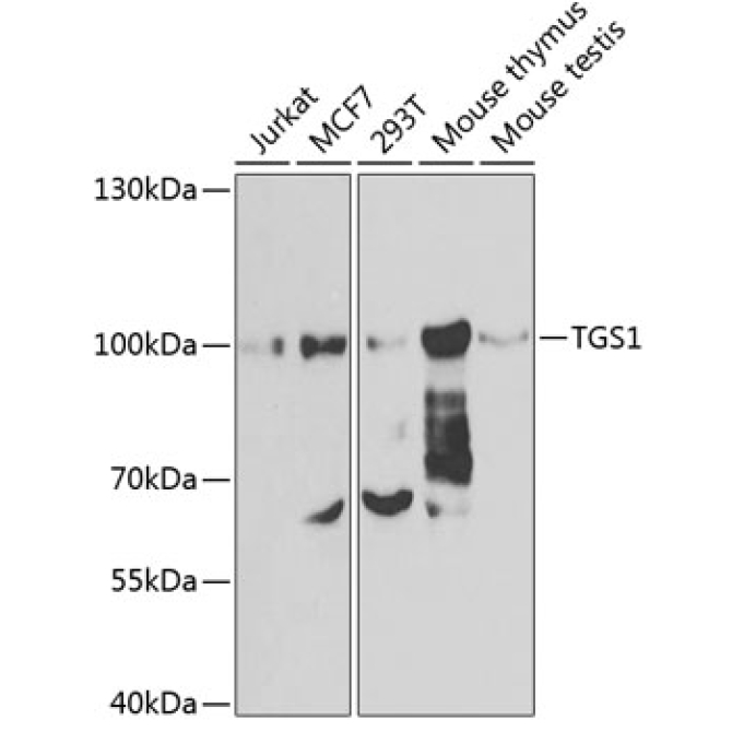TGS1 Rabbit Polyclonal Antibody