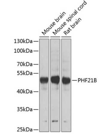 PHF21B Rabbit Polyclonal Antibody