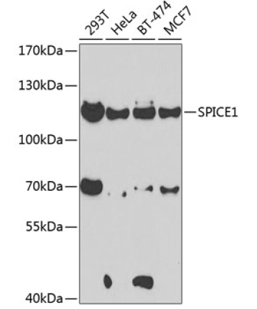 SPICE1 Rabbit Polyclonal Antibody