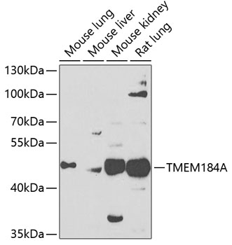 TMEM184A Rabbit Polyclonal Antibody