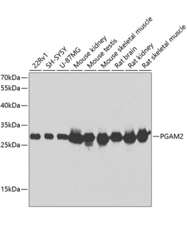 PGAM2 Rabbit Polyclonal Antibody