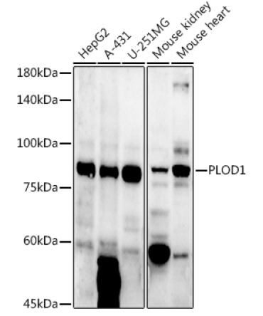 PLOD1 Rabbit Polyclonal Antibody