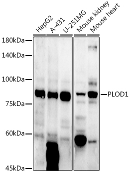 PLOD1 Rabbit Polyclonal Antibody