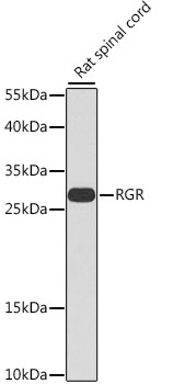 RGR Rabbit Polyclonal Antibody