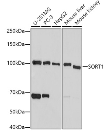 SORT1 Rabbit Polyclonal Antibody