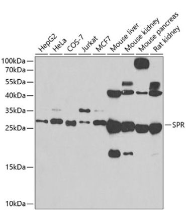 SPR Rabbit Polyclonal Antibody