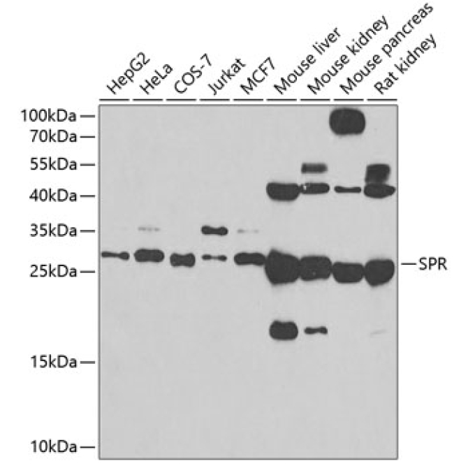 SPR Rabbit Polyclonal Antibody
