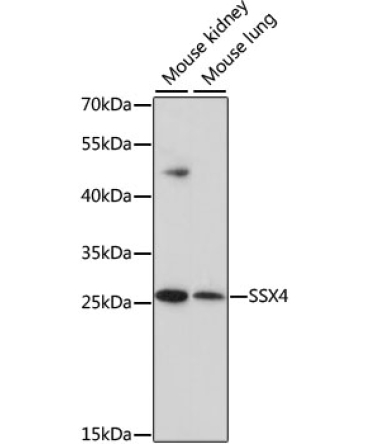 SSX4 Rabbit Polyclonal Antibody