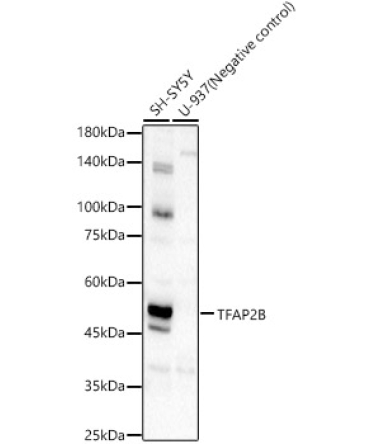 TFAP2B Rabbit Polyclonal Antibody