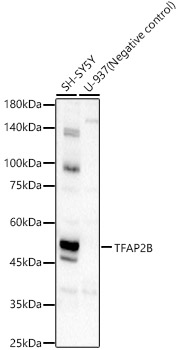 TFAP2B Rabbit Polyclonal Antibody