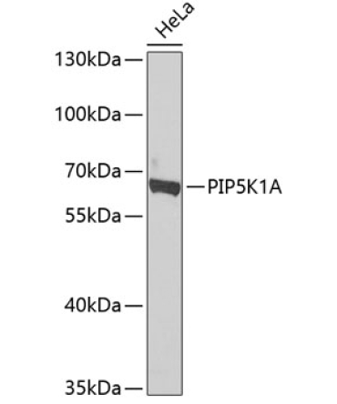 PIP5K1A Rabbit Polyclonal Antibody