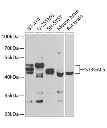 ST3GAL5 Rabbit Polyclonal Antibody