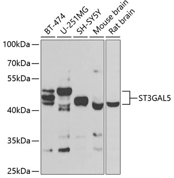 ST3GAL5 Rabbit Polyclonal Antibody