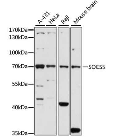 SOCS5 Rabbit Polyclonal Antibody