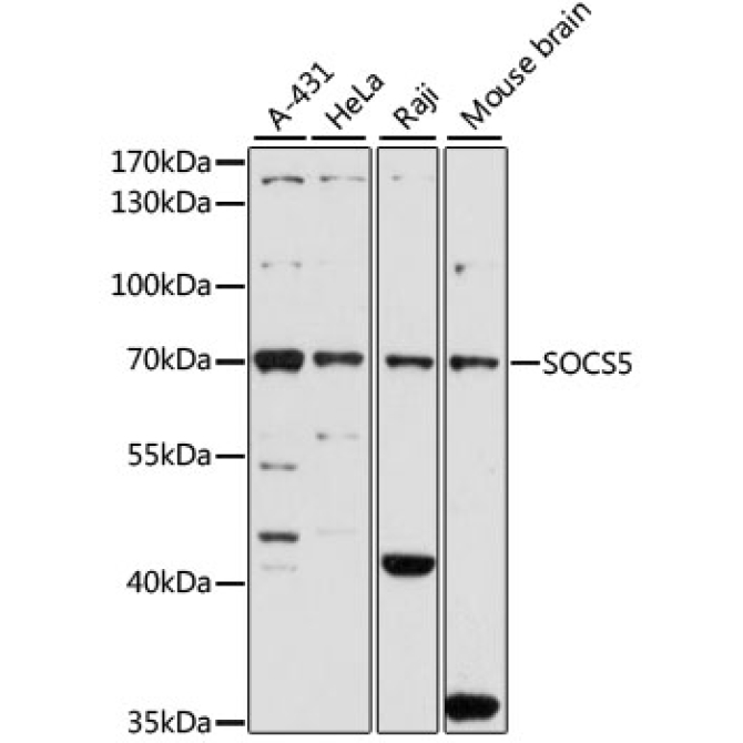 SOCS5 Rabbit Polyclonal Antibody