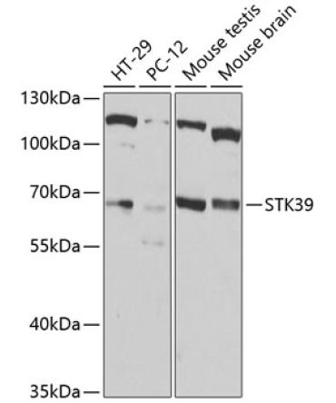 STK39 Rabbit Polyclonal Antibody