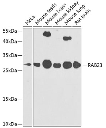 RAB23 Rabbit Polyclonal Antibody