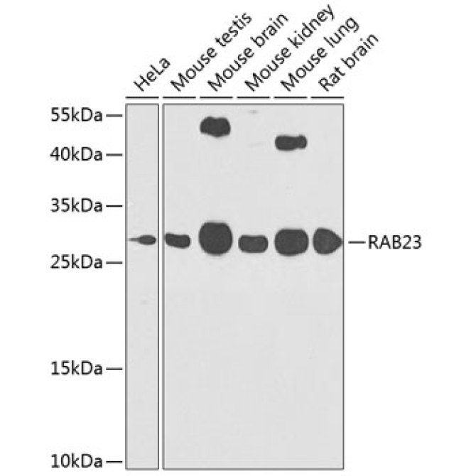 RAB23 Rabbit Polyclonal Antibody