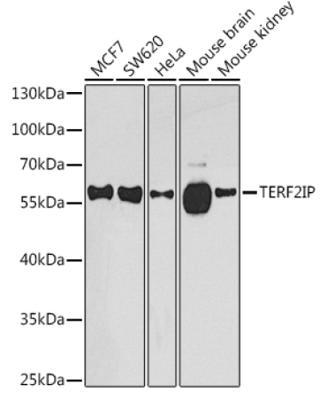TERF2IP Rabbit Polyclonal Antibody