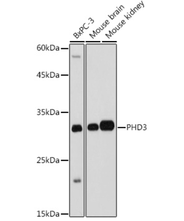 PHD3 Rabbit Polyclonal Antibody