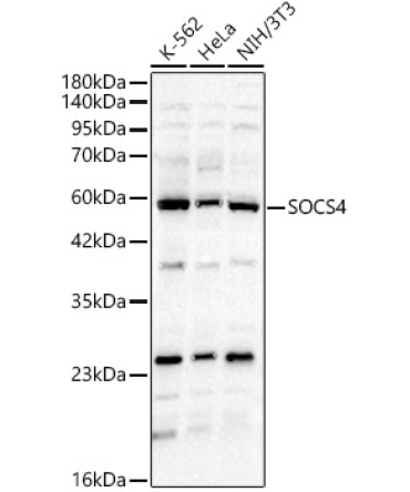SOCS4 Rabbit Polyclonal Antibody