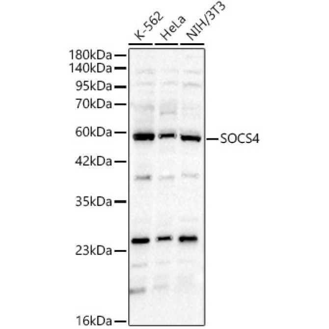 SOCS4 Rabbit Polyclonal Antibody