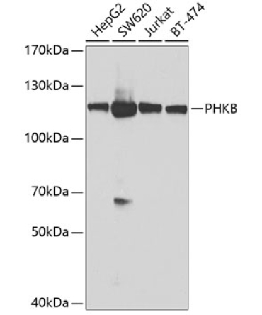 PHKB Rabbit Polyclonal Antibody