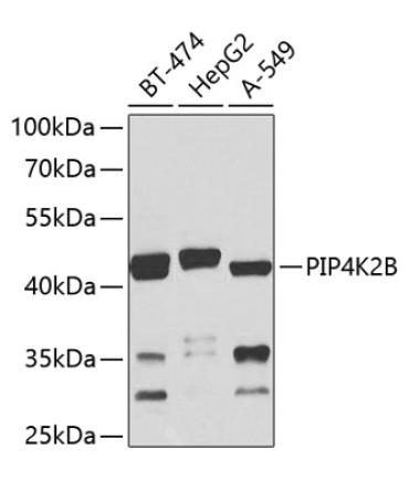 PIP4K2B Rabbit Polyclonal Antibody