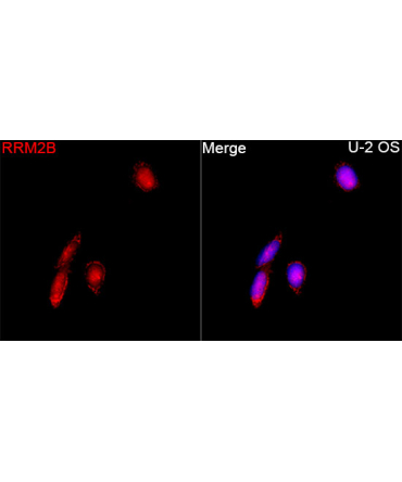 RRM2B Rabbit Polyclonal Antibody