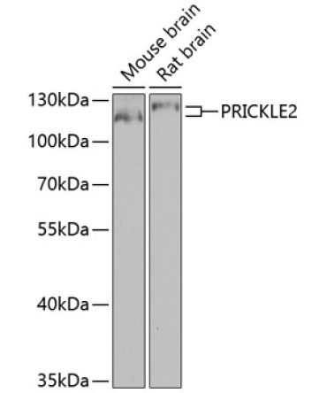 PRICKLE2 Rabbit Polyclonal Antibody