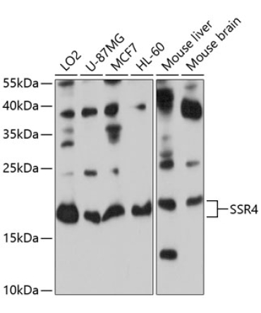 SSR4 Rabbit Polyclonal Antibody