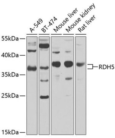 RDH5 Rabbit Polyclonal Antibody