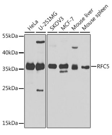 RFC5 Rabbit Polyclonal Antibody