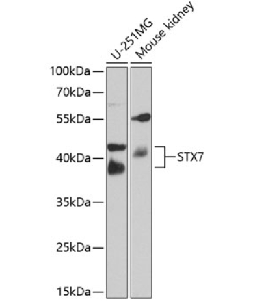 STX7 Rabbit Polyclonal Antibody