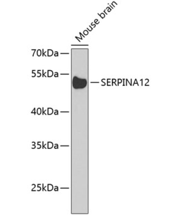 SERPINA12 Rabbit Polyclonal Antibody
