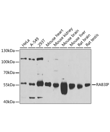 RAB3IP Rabbit Polyclonal Antibody