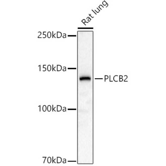 PLCB2 Rabbit Polyclonal Antibody