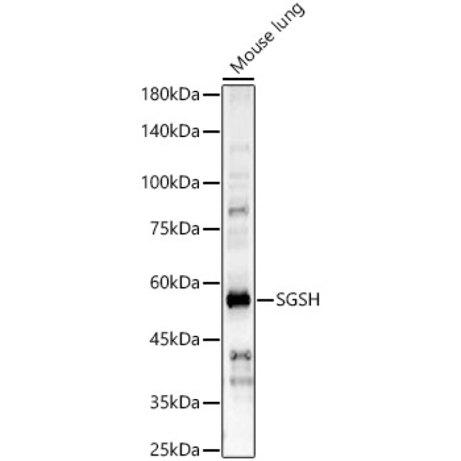 SGSH Rabbit Polyclonal Antibody
